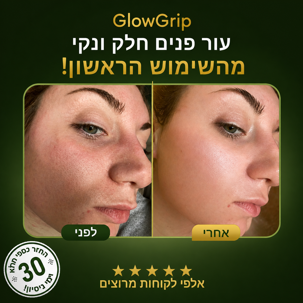 ™GlowGrip -  לפנים חלקות