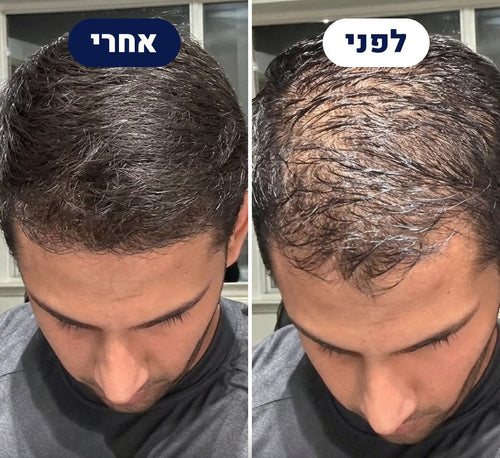 לפני ואחרי של לקוח THICKUP, צילום מלמעלה של קו השיער