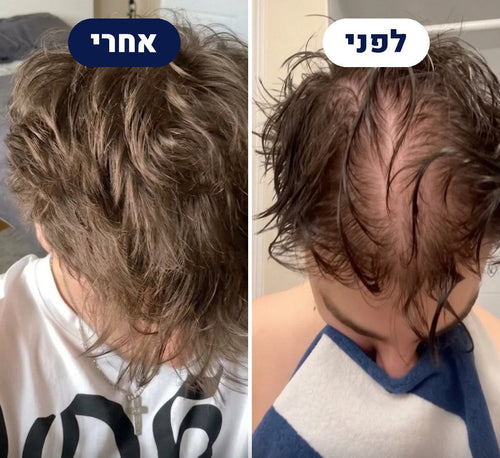 לפני ואחרי של לקוח THICKUP, צילום מלמעלה של השיער