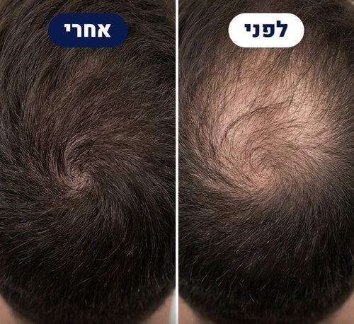 לפני ואחרי של לקוח THICKUP, צילום של הקודקוד