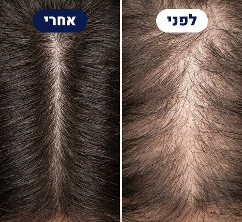 לפני ואחרי של לקוח THICKUP, צילום של השביל